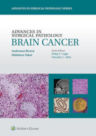 Title: Advances in Surgical Pathology: Brain Cancer, Author: Andreana Rivera