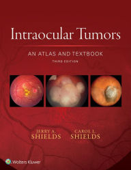 Title: Intraocular Tumors: An Atlas and Textbook, Author: Jerry A. Shields