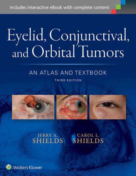 Eyelid, Conjunctival, and Orbital Tumors: An Atlas and Textbook / Edition 3