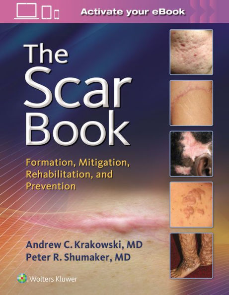 Traumatic Scar Tissue Management: Principles and Practice for Manual Therapy