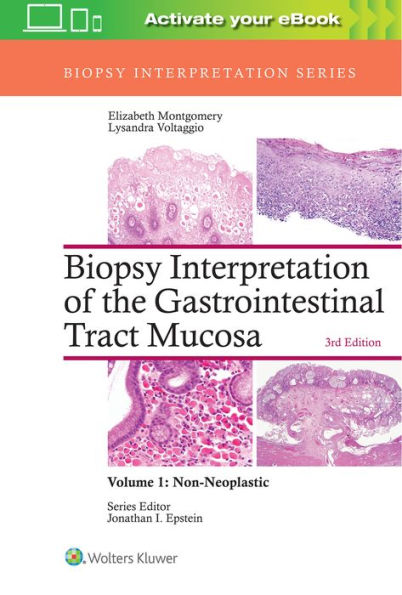 Biopsy Interpretation of the Gastrointestinal Tract Mucosa: Volume 1: Non-Neoplastic / Edition 3