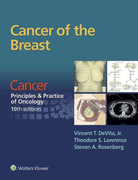 Cancer of the Breast: From Cancer: Principles & Practice of Oncology ...