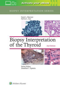 Title: Biopsy Interpretation of the Thyroid / Edition 2, Author: Scott L. Boerner MD