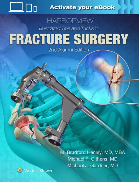 Harborview Illustrated Tips and Tricks in Fracture Surgery / Edition 2