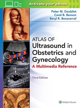 Atlas of Ultrasound in Obstetrics and Gynecology / Edition 3