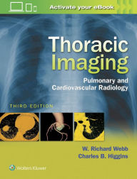 Title: Thoracic Imaging: Pulmonary and Cardiovascular Radiology, Author: W. Richard Webb