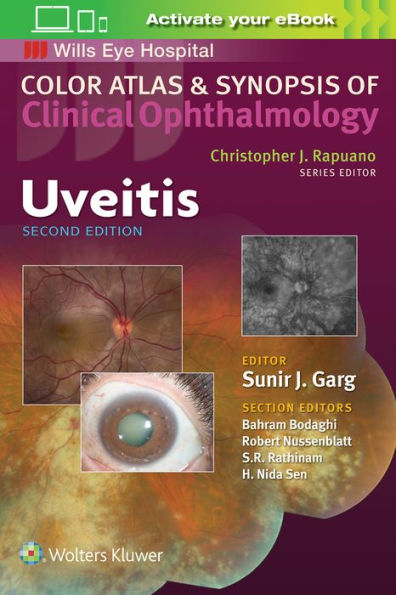 Uveitis / Edition 2