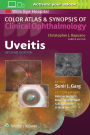 Uveitis / Edition 2