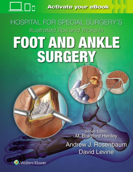 Hospital for Special Surgery's Illustrated Tips and Tricks in Foot and Ankle Surgery / Edition 1