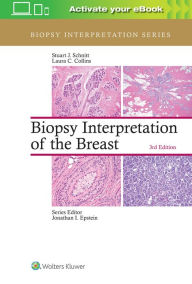 Title: Biopsy Interpretation of the Breast / Edition 3, Author: Stuart J. Schnitt MD