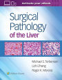 Surgical Pathology of the Liver / Edition 1