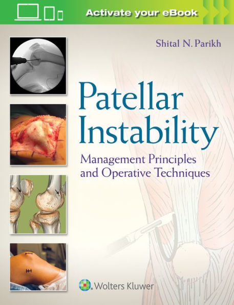 Patellar Instability: Management Principles and Operative Techniques / Edition 1