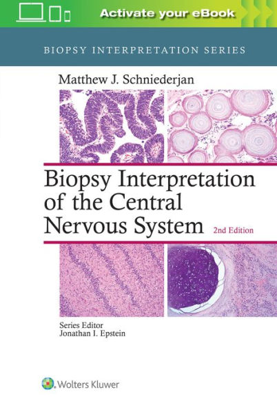 Biopsy Interpretation of the Central Nervous System / Edition 2