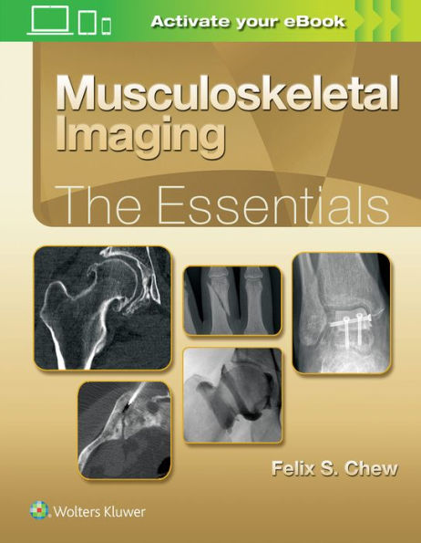 Musculoskeletal Imaging: The Essentials / Edition 1
