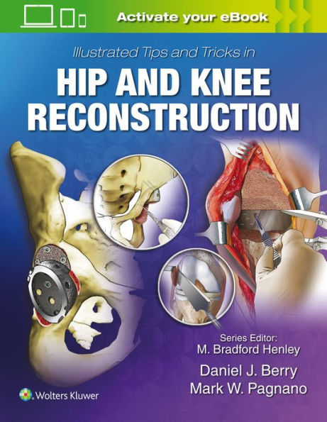 Illustrated Tips and Tricks in Hip and Knee Reconstructive and Replacement Surgery / Edition 1