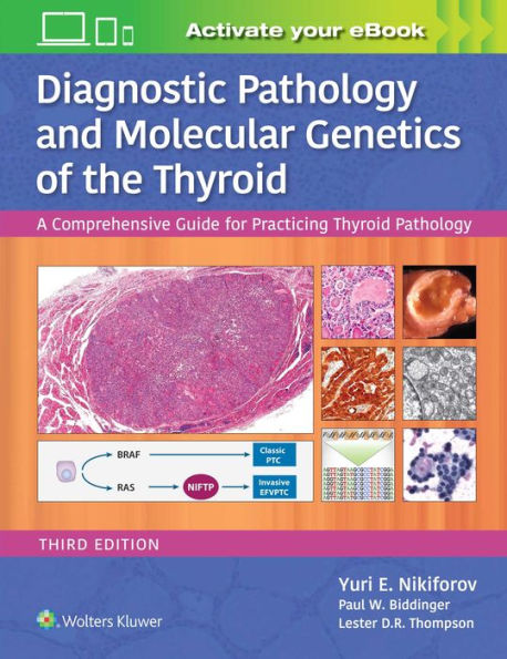 Diagnostic Pathology and Molecular Genetics of the Thyroid: A Comprehensive Guide for Practicing Thyroid Pathology / Edition 3