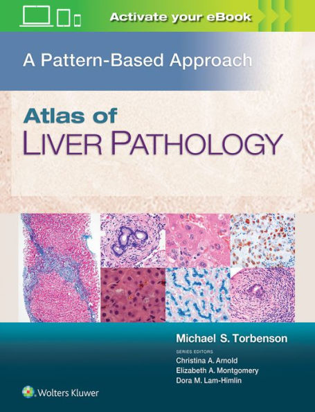 Atlas of Liver Pathology: A Pattern-Based Approach / Edition 1