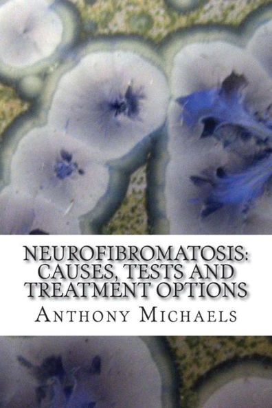 Neurofibromatosis: Causes, Tests and Treatment Options