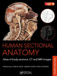 Title: Human Sectional Anatomy: Atlas of Body Sections, CT and MRI Images, Fourth Edition / Edition 4, Author: Adrian K. Dixon