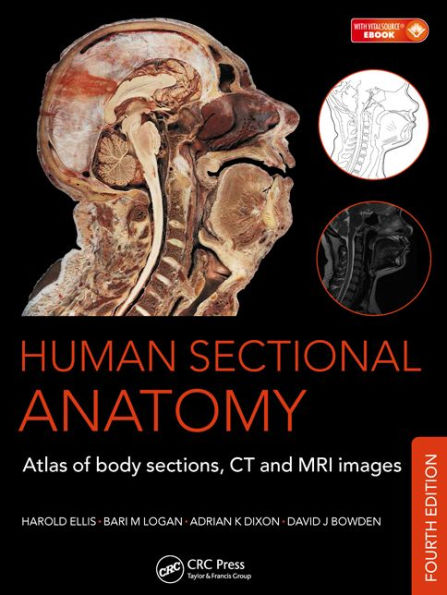 Human Sectional Anatomy: Atlas of Body Sections, CT and MRI Images, Fourth Edition / Edition 4