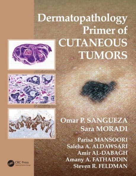 Dermatopathology Primer of Cutaneous Tumors / Edition 1