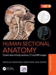 Title: Human Sectional Anatomy: Pocket atlas of body sections, CT and MRI images, Fourth edition, Author: Adrian Kendal Dixon