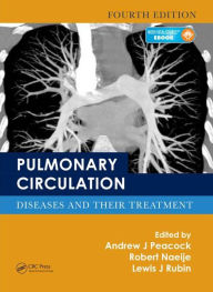 Download books ipod nano Pulmonary Circulation: Diseases and Their Treatment, Fourth Edition 9781498719919 RTF