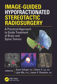 Audio books download itunes Image-Guided Hypofractionated Stereotactic Radiosurgery: A Practical Approach to Guide Treatment of Brain and Spine Tumors FB2 by Arjun Sahgal 9781498722834 (English Edition)