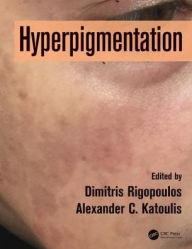 Title: Hyperpigmentation / Edition 1, Author: Dimitris Rigopoulos