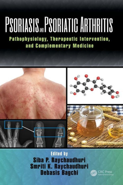 Psoriasis and Psoriatic Arthritis: Pathophysiology, Therapeutic Intervention, and Complementary Medicine / Edition 1