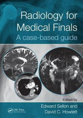 Radiology for Medical Finals: A case-based guide / Edition 1