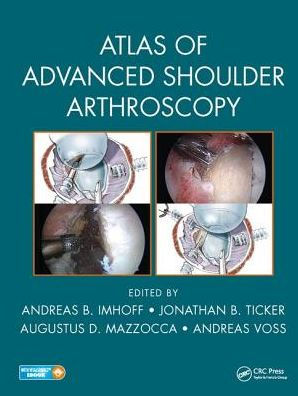 Atlas of Advanced Shoulder Arthroscopy / Edition 1