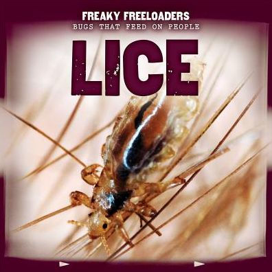 Lice