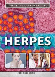 Title: Herpes, Author: Jeri Freedman