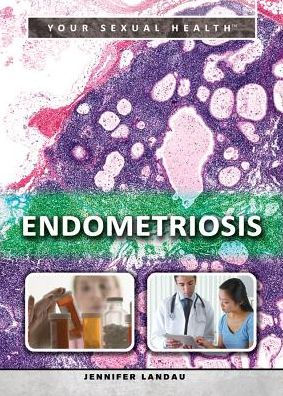 Endometriosis