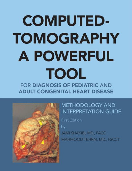 Computed-Tomography a Powerful Tool for Diagnosis of Pediatric and Adult Congenital Heart Disease: Methodology and Interpretation Guide
