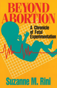 Title: Beyond Abortion: A Chronicle of Fetal Experimentation, Author: Suzanne Rini