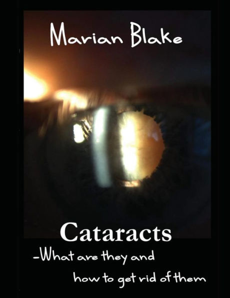 Cataracts: What are they and how to get rid of them?