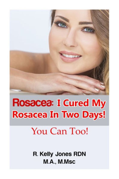 Rosacea: I Cured My Rosacea In Two Days! You Can Too!