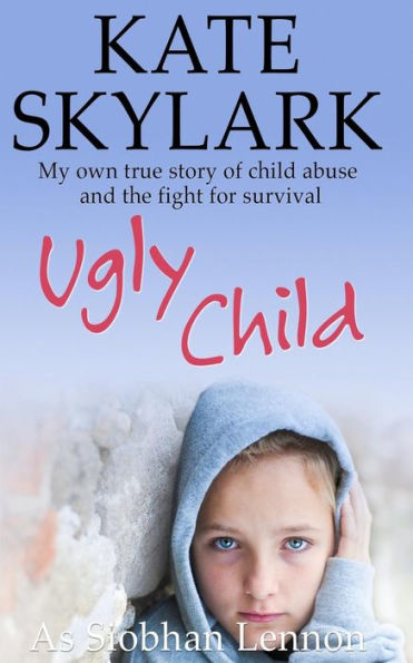 Ugly Child: My Own True Story of Child Abuse and the Fight for Survival