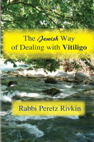 The Jewish Way of Dealing With Vitiligo