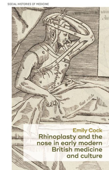 Rhinoplasty and the nose early modern British medicine culture