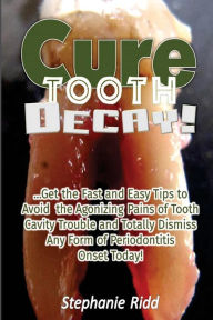 Title: Cure Tooth Decay!: Get the Fast and Easy Tips to Avoid the Agonizing Pains of Tooth Cavity Trouble and Totally Dismiss Any Form of Periodontitis Onset Today!, Author: Stephanie Ridd