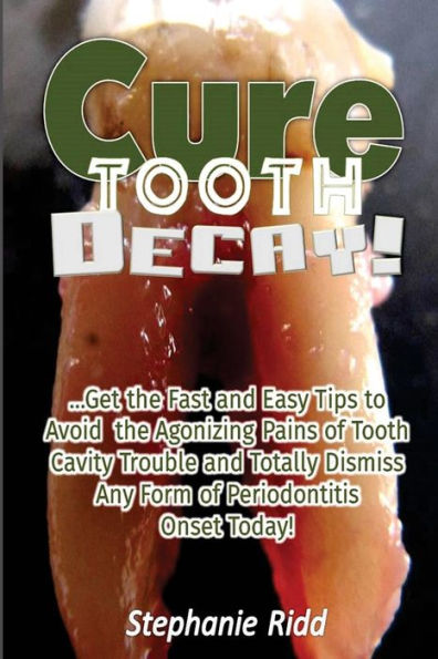 Cure Tooth Decay!: Get the Fast and Easy Tips to Avoid the Agonizing Pains of Tooth Cavity Trouble and Totally Dismiss Any Form of Periodontitis Onset Today!