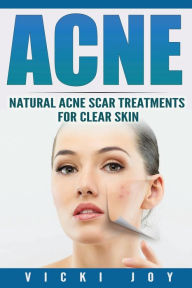 Title: Acne: Natural Acne Scar Treatments for Clear Skin, Author: Vicki Joy