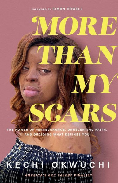More Than My Scars: The Power of Perseverance, Unrelenting Faith, and Deciding What Defines You