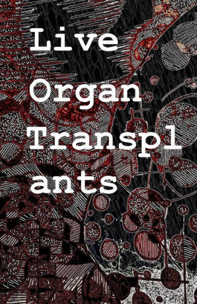 Live Organ Transplants