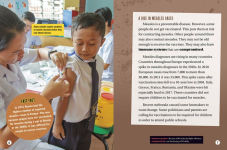 Alternative view 3 of Measles: How a Contagious Rash Changed History