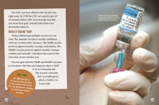 Alternative view 5 of Measles: How a Contagious Rash Changed History