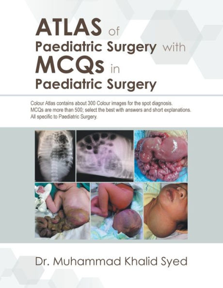 Atlas of Paediatric Surgery with Mcqs